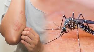 Dengue-Chikungunya